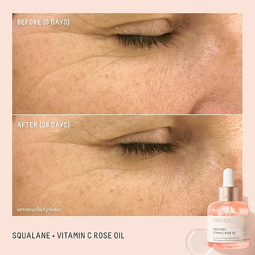 BIOSSANCE Squalane + Vitamin C Rose Advanced Facial Oil – Brightening, Firming & Hydrating Face Oil with Squalane, Vitamin C, Chios Crystal Oil & Damascus Rose Extract for All Skin Types